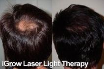 iGrow Laser Light Therapy