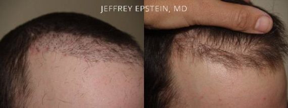 Reparative Before and after in Miami, FL, Paciente 40299