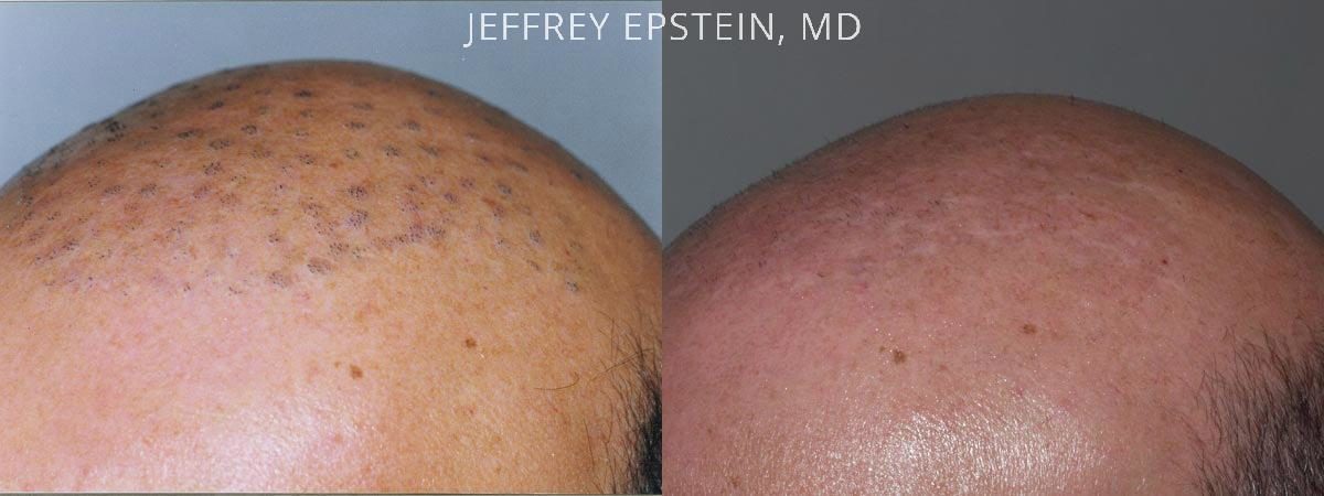 Reparative Before and after in Miami, FL, Paciente 40341