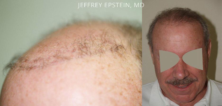 Reparative Before and after in Miami, FL, Paciente 40474