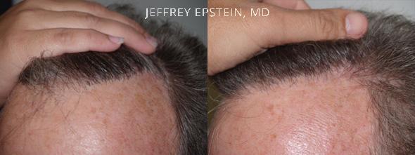 Reparative Before and after in Miami, FL, Paciente 40750