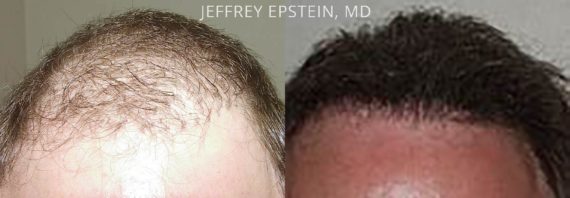 Reparative Before and after in Miami, FL, Paciente 40807