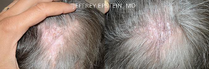 Reparative Before and after in Miami, FL, Paciente 40845