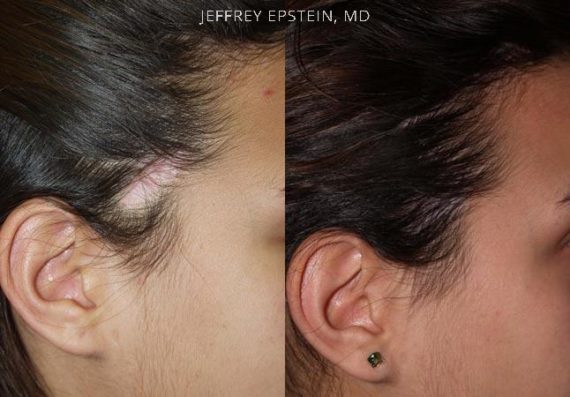 Special Cases Before and after in Miami, FL, Paciente 40969