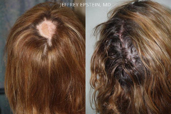 Special Cases Before and after in Miami, FL, Paciente 41132
