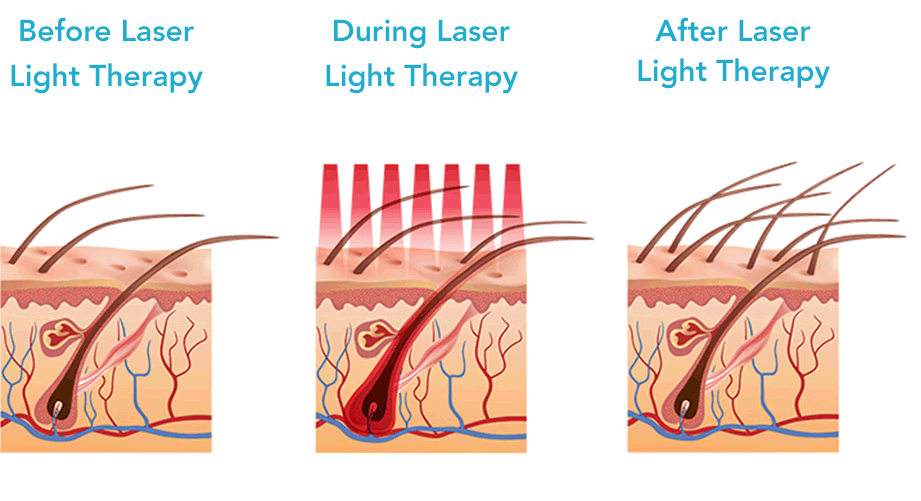 Foundation Light Therapy (FLT)