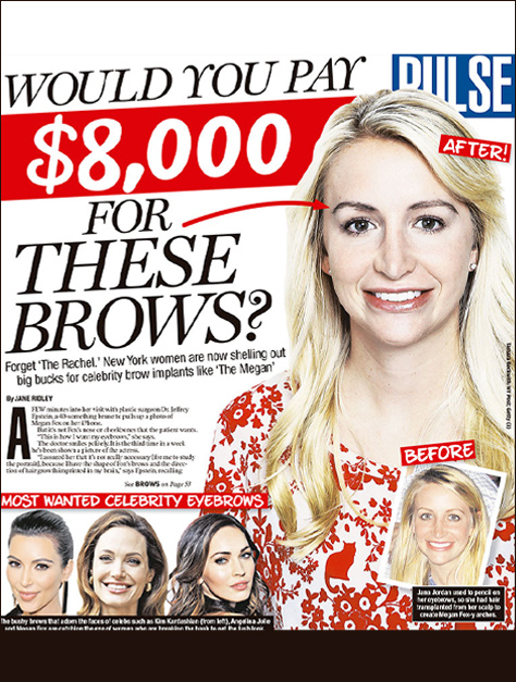 Women are now shelling out big bucks for celebrity brow implants