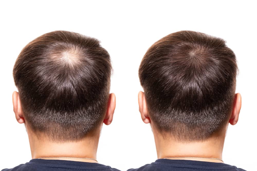 Healthy-looking hair is important to both men and women