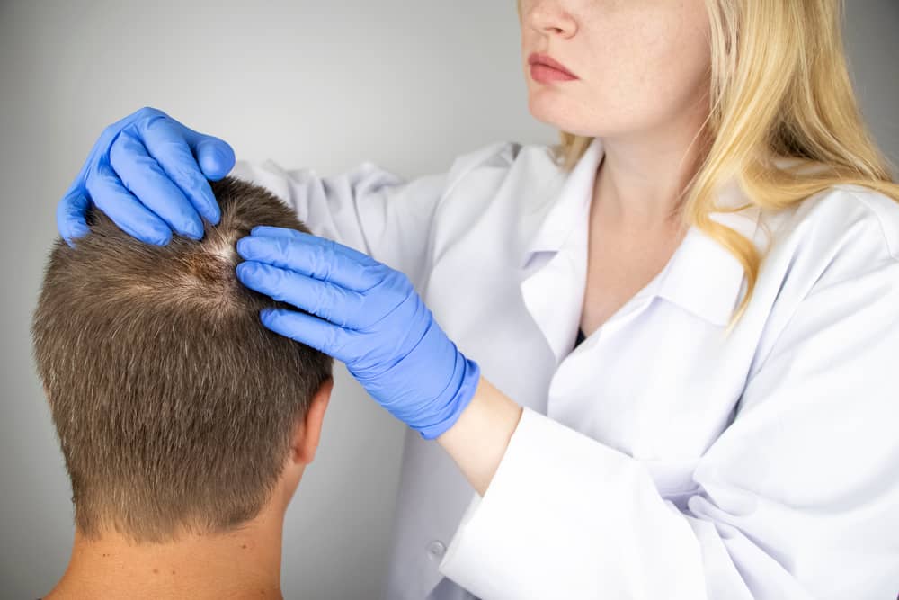 Hair Transplant Post-Op Instructions | Hair Transplant Expectations