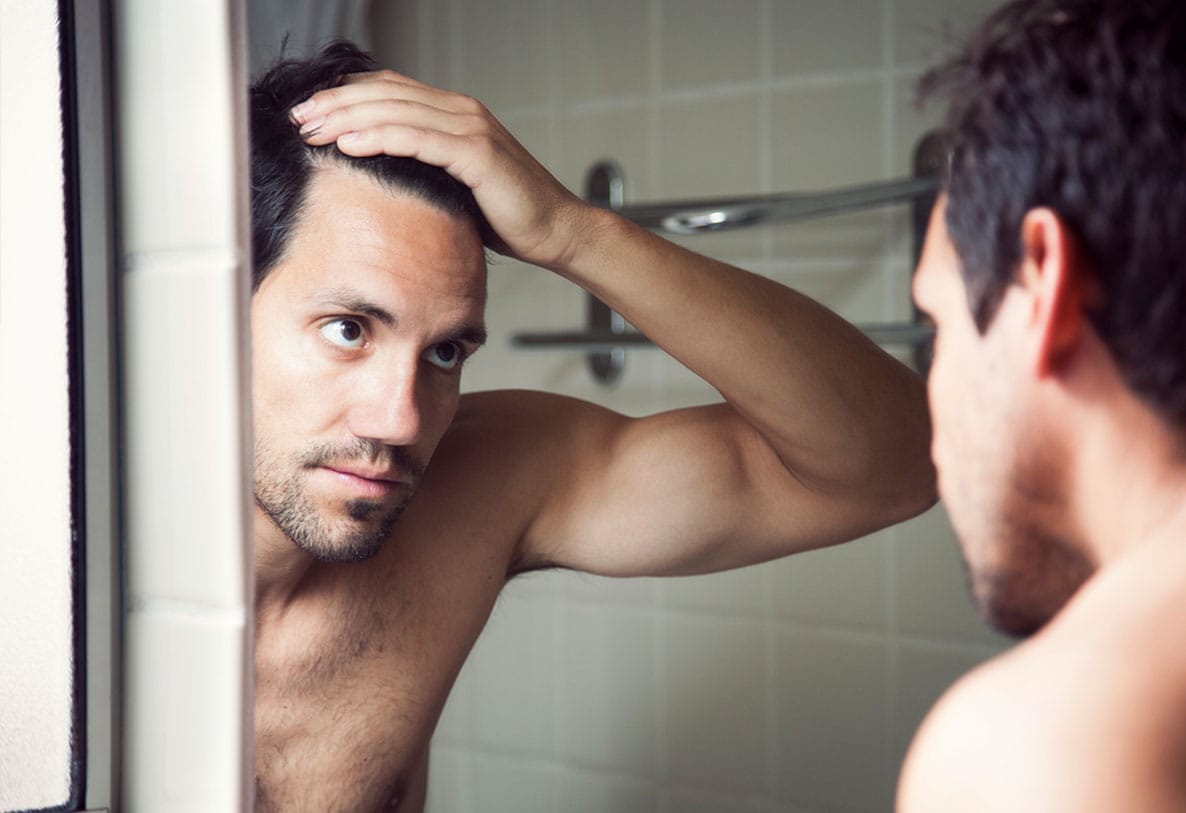 man looking at his hairline before his hair transplant in Miami, FL